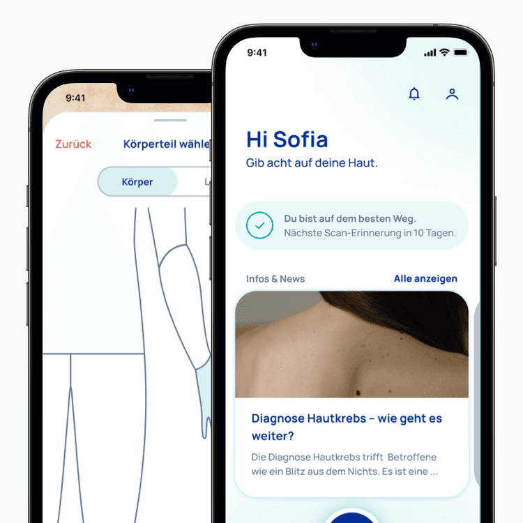 SkinScreener App